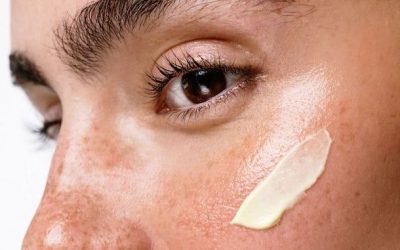 Manchas y melasma: cómo tratarlos antes del verano